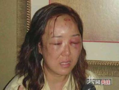 Chinese businesswoman Zhao Yan, who sued the U.S. government after she was beaten and injured by a U.S. border inspector at the Niagara Falls in 2004. [File Photo: CCTV]